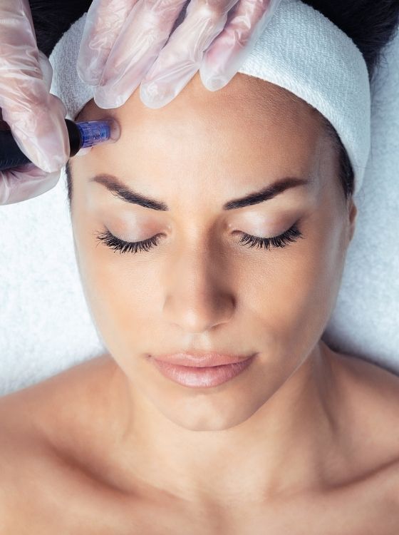 Microneedling Dermatoloy Center of Atlanta