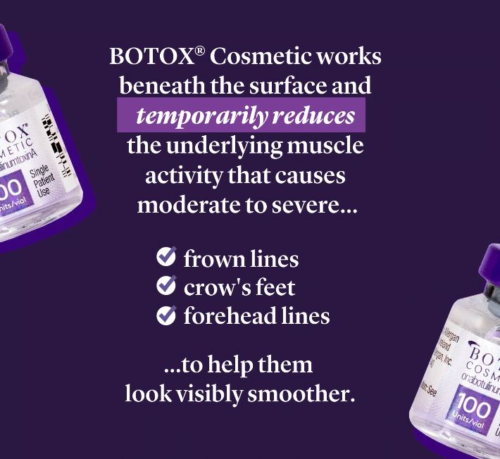 Botox temporarily reduces activity in three areas