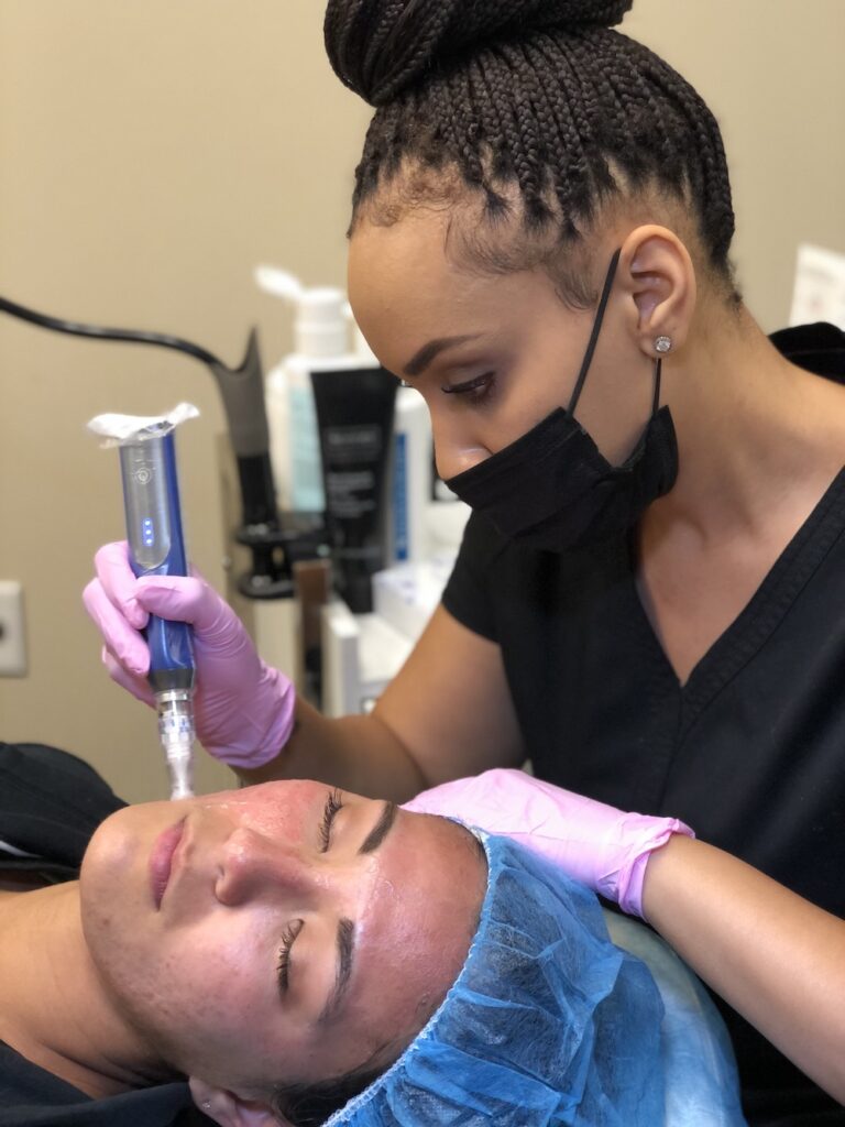 Microneedling Treatment advanced SkinCare Center