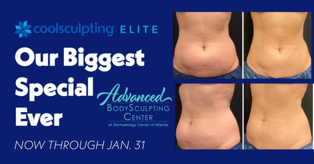 Our Biggest CoolSculpting Special Ever