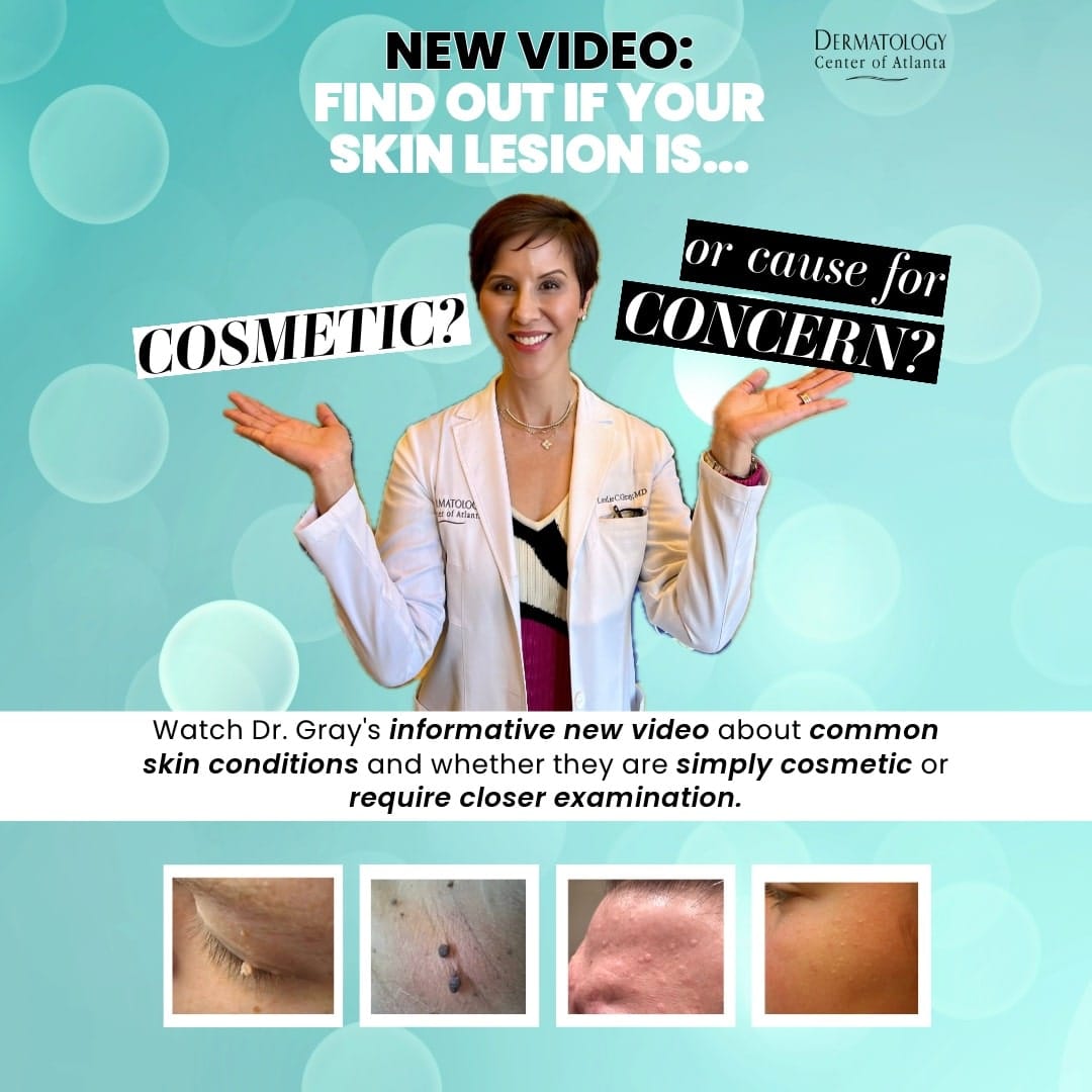 Video: Cosmetic or Cause for Concern with Dr. Leslie Gray