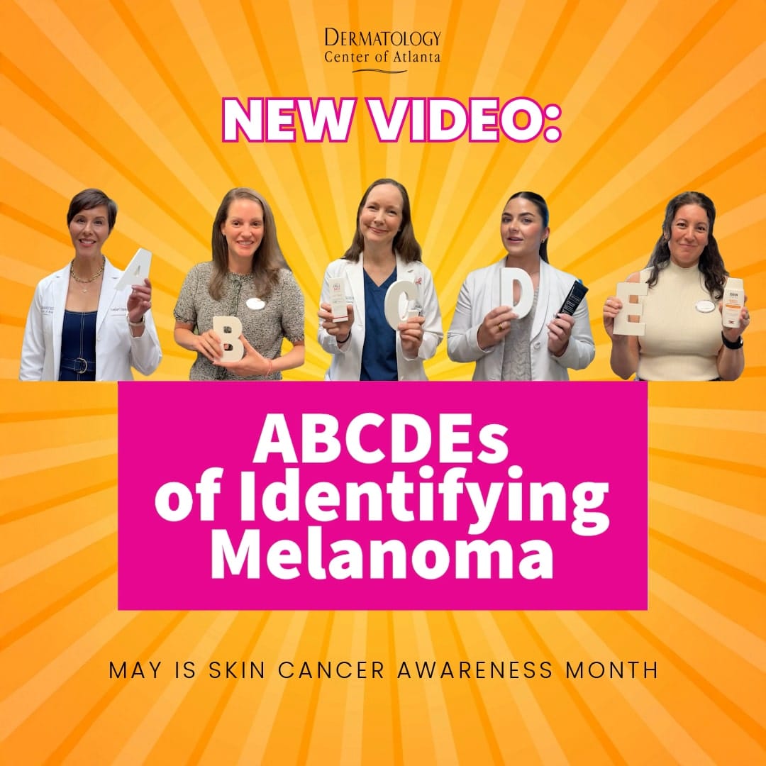 New Video how to identify melanoma with the DCA providers