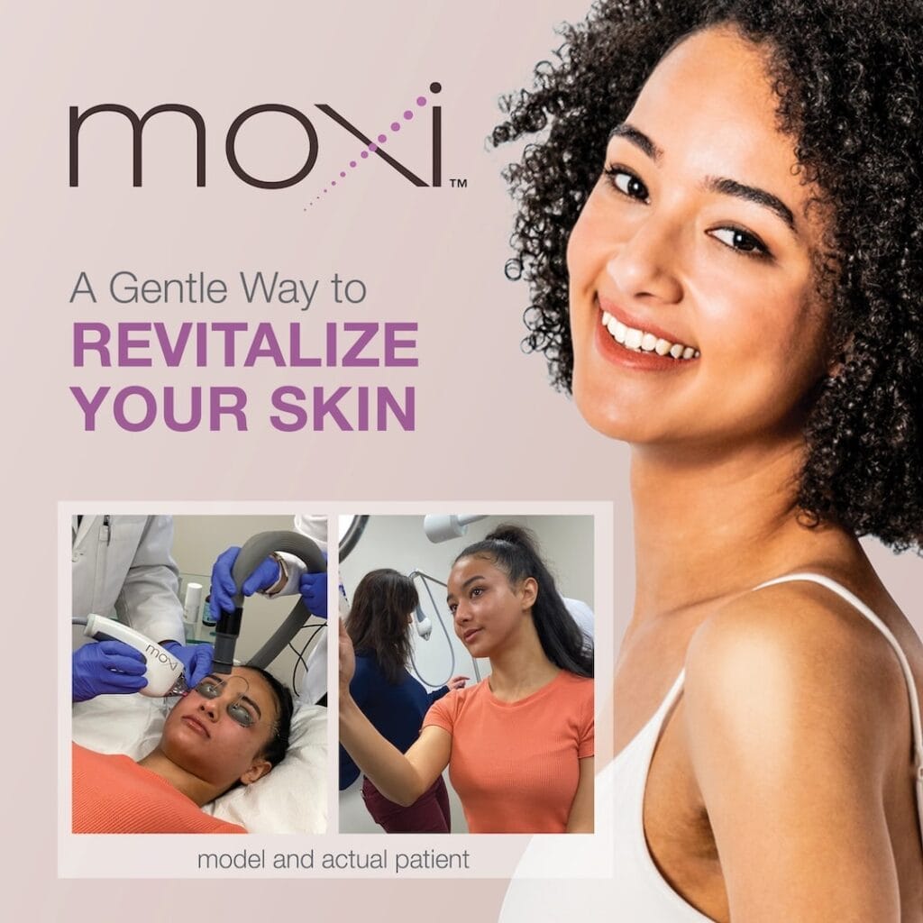 Moxi a gentle way to revitalize skin