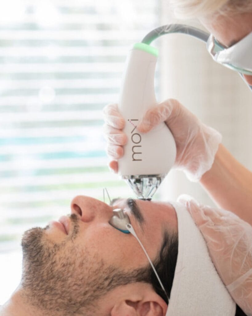 moxi-laser-treatments-for-men