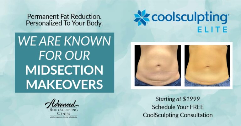 CoolSculpting Elite DCA home of the midsection makeover